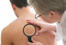 Фото - Как предотвратить меланому: из-за чего загар может вызвать рак кожи