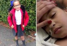 Фото - Медики спасли 10-летнюю девочку после шестиминутной смерти